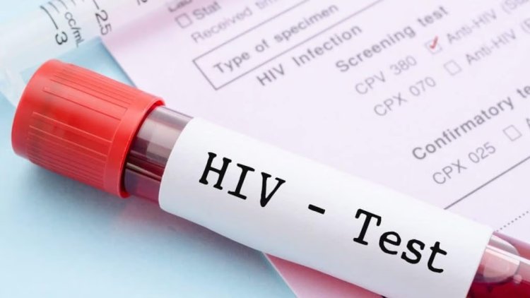 Cientistas anunciam novo caso de remissão do HIV após transplante de medula óssea